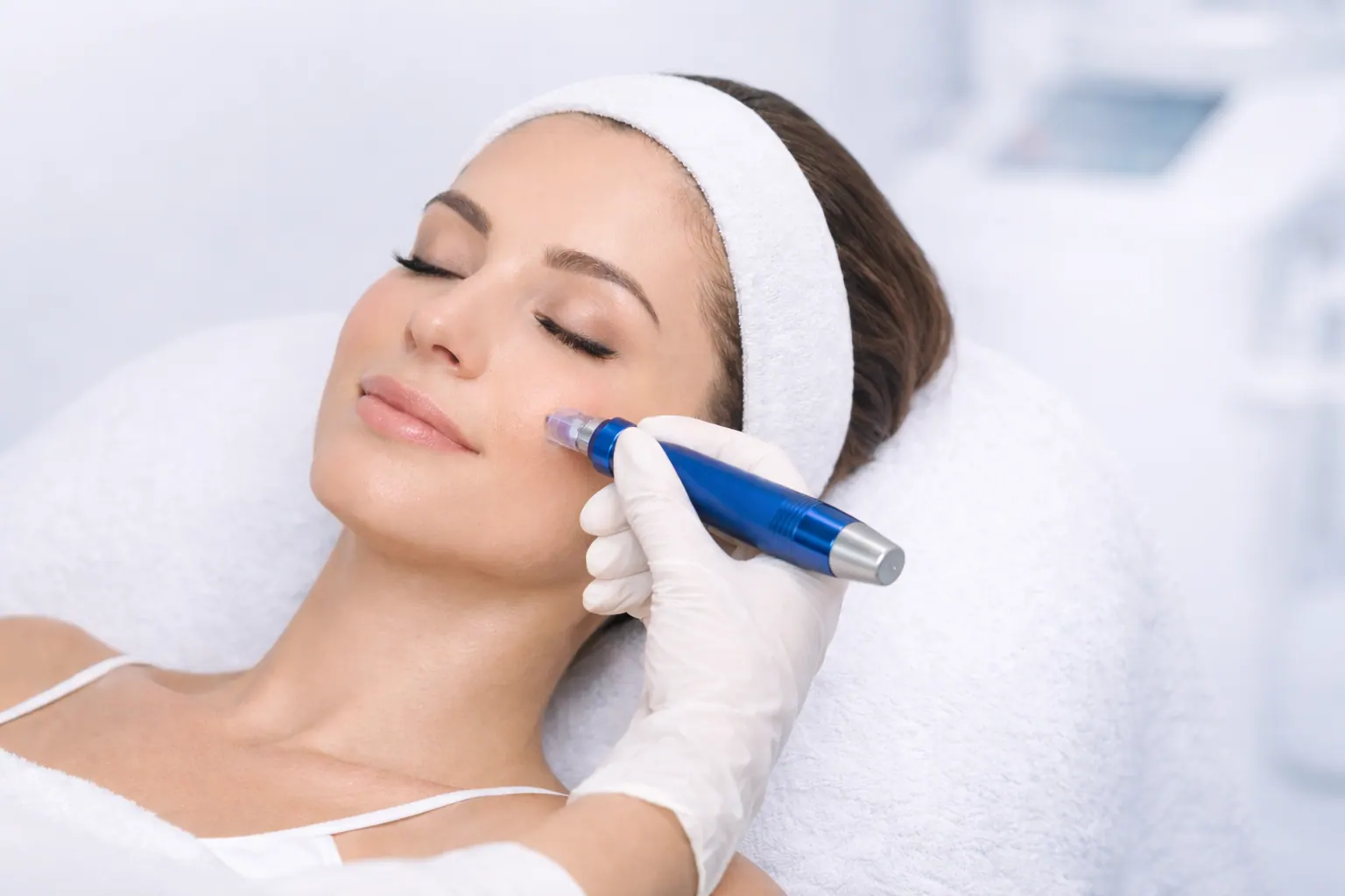 Fotografía original de micropunción facial con su manípulo · Clínica Sacher en Ontinyent, Valencia.